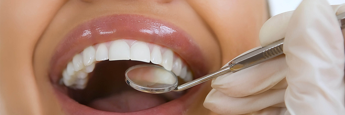 Routine Dental Check-up and Cleaning Services in Goregaon